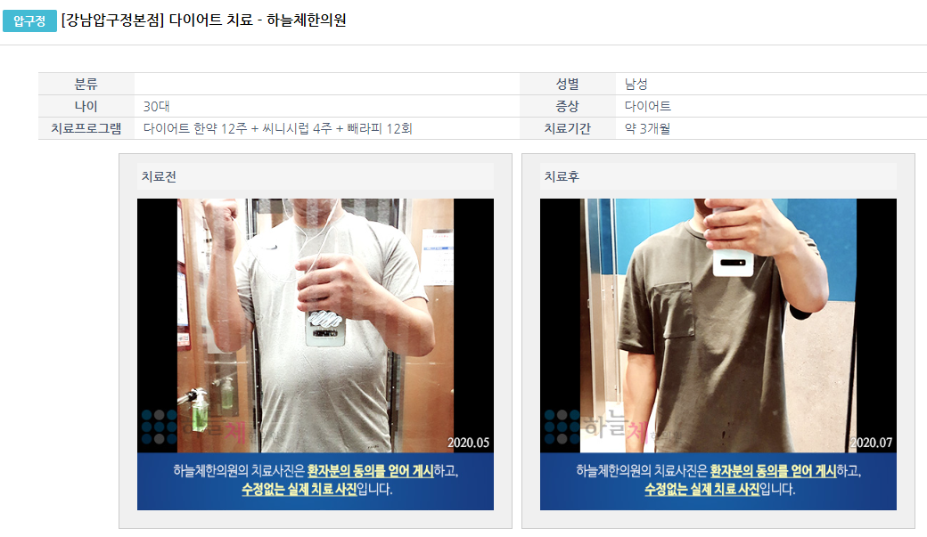 (다이어트) 남성의 다이어트 전후 지방간 임상사례 2