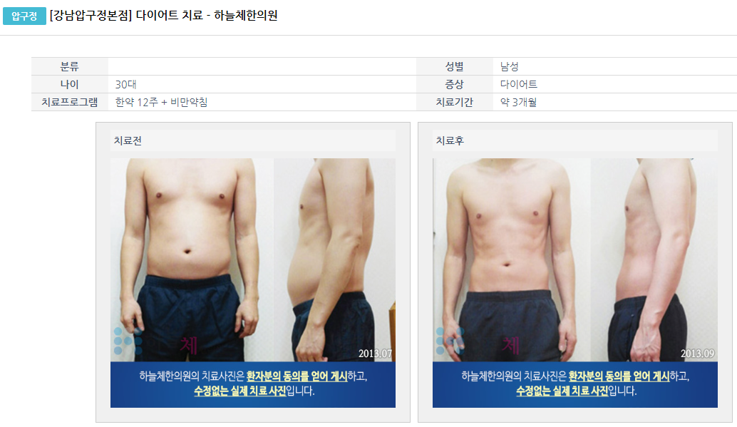 (다이어트) 남성의 다이어트 전후 지방간 임상사례
